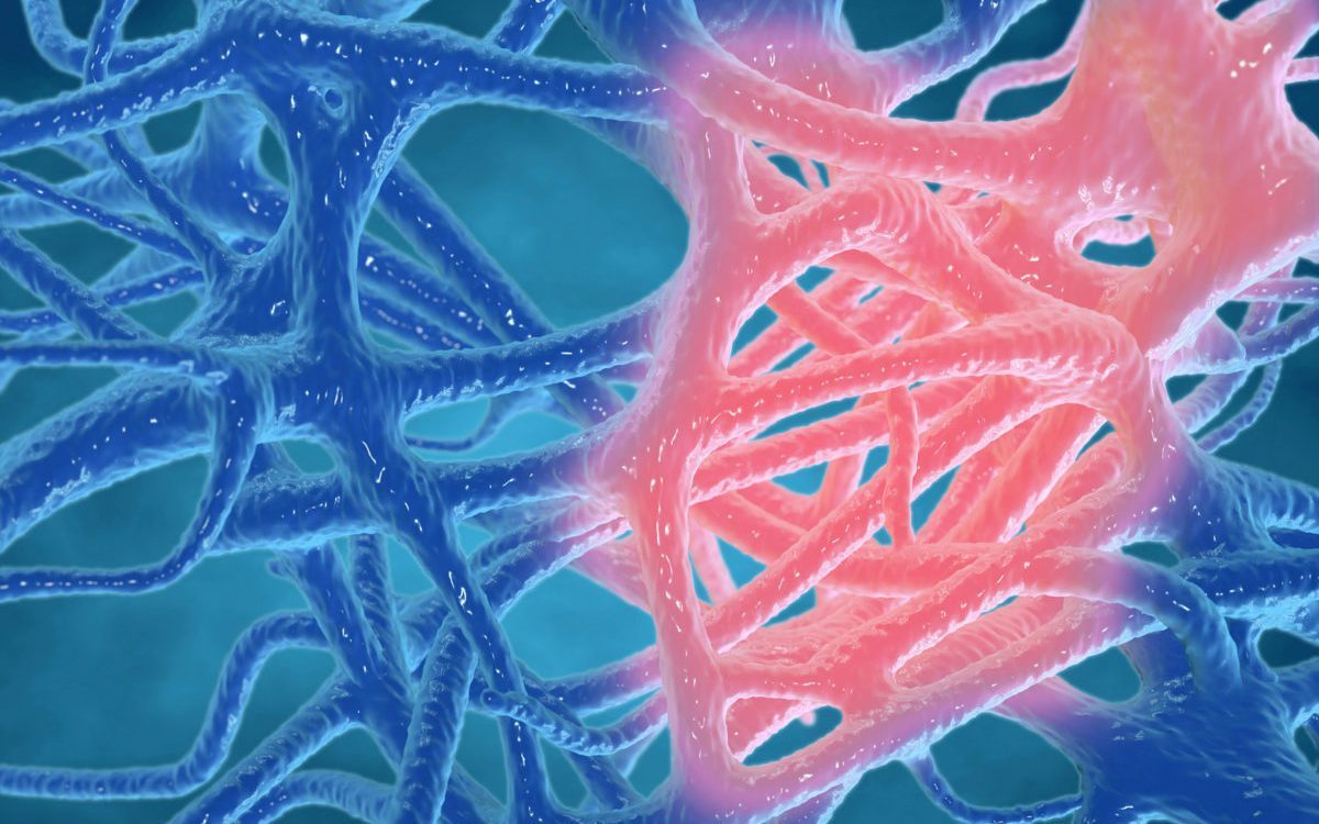 Nutrition and Cancer | The Inflammation Connection