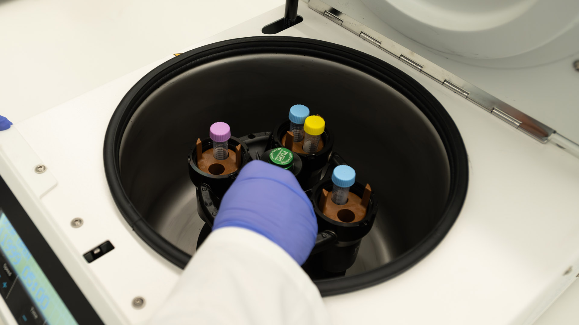 Evolve Human Sample Preparation (2)
